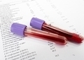 Лаборатория анализ крови на гепатит thumbnail