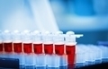 Анализы крови для определения количества лейкоцитов thumbnail