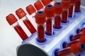 Общий клинический анализ крови как делают thumbnail