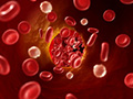 Общий анализ крови расшифровка у взрослых холестерин thumbnail