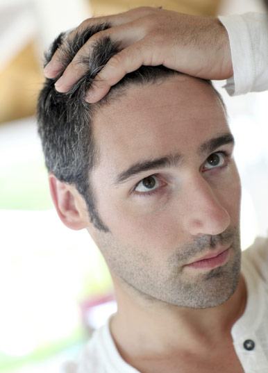 причины выпадения волос у мужчин