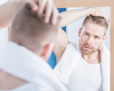 Как спасти волосы от облысения мужчин thumbnail