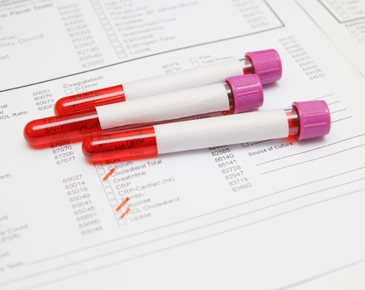 Как проводится анализ крови на тромбоциты и о чем могут сказать его результаты? thumbnail