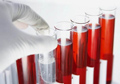 Как правильно сдать анализ крови на гормон пролактин у женщин thumbnail